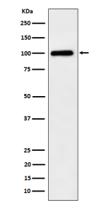 Western blot analysis of Desmocollin 1 expression in human A375 cell lysate using BCLAF1 antibody. Predicted molecular weight ~100 kDa.