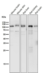 Western blot testing of mouse and rat samples using the BCLAF1 antibody at 1:1000 dilution for 1 hour at room temperature. Predicted molecular weight ~100 kDa.