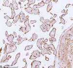 Immunohistochemical staining of using anti-ME3 antibody. ME3 was detected in a paraffin-embedded section of human placenta tissue. Heat mediated antigen retrieval was performed in EDTA buffer (pH 8.0, epitope retrieval solution). The tissue section was blocked with 10% goat serum. The tissue section was then incubated with 2 ug/ml rabbit anti-ME3 antibody overnight at 4oC. Peroxidase Conjugated Goat Anti-rabbit IgG was used as secondary antibody and incubated for 30 minutes at 37oC. The tissue section was developed using an HRP secondary and DAB substrate.
