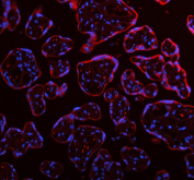 Immunofluorescent staining of FFPE human placental tissue with ME3 antibody (red) and DAPI nuclear stain (blue). HIER: steam section in pH8 EDTA buffer for 20 min.