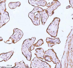 Immunohistochemical staining of using anti-ME3 antibody. ME3 was detected in a paraffin-embedded section of human placenta tissue. Heat mediated antigen retrieval was performed in EDTA buffer (pH 8.0, epitope retrieval solution). The tissue section was blocked with 10% goat serum. The tissue section was then incubated with 2 ug/ml rabbit anti-ME3 antibody overnight at 4oC. Peroxidase Conjugated Goat Anti-rabbit IgG was used as secondary antibody and incubated for 30 minutes at 37oC. The tissue section was developed using an HRP secondary and DAB substrate.