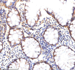 Immunohistochemical staining of MATK using anti-MATK antibody. MATK was detected in a paraffin-embedded section of human colon tissue. Heat mediated antigen retrieval was performed in EDTA buffer (pH 8.0, epitope retrieval solution). The tissue section was blocked with 10% goat serum. The tissue section was then incubated with 2 ug/ml rabbit anti-MATK antibody overnight at 4oC. Peroxidase Conjugated Goat Anti-rabbit IgG was used as secondary antibody and incubated for 30 minutes at 37oC. The tissue section was developed using an HRP secondary and DAB substrate.