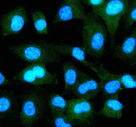 Immunofluorescent staining of EPS8 using anti-EPS8 antibody (green). EPS8 was detected in an immunocytochemical section of cells. Enzyme antigen retrieval was performed using IHC enzyme antigen retrieval reagent for 15 mins. The cells were blocked with 10% goat serum. And then incubated with 5 ug/ml rabbit anti-EPS8 antibody overnight at 4oC. DyLight 488 Conjugated Goat Anti-Rabbit IgG was used as secondary antibody at 1:500 dilution and incubated for 30 minutes at 37oC. The section was counterstained with DAPI nuclear stain (blue). Visualize using a fluorescence microscope and filter sets appropriate for the label used.