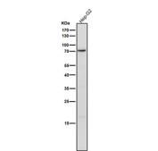 Western blot testing of huma HepG2 cell lysate using the Phospho-PKC delta (Tyr311) antibody at 1:1000 dilution for 1 hour at room temperature. Predicted molecular weight ~75 kDa.
