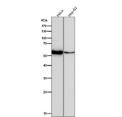 Western blot testing of human samples using the LYN antibody at 1:1000 dilution for 1 hour at room temperature. Predicted molecular weight ~53 kDa (p53lyn), ~56 kDa (p56lyn).