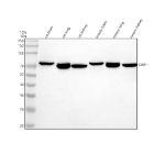 Western blot analysis of CDKN2AIP/CARF using anti-Carf antibody. Lane 1: rat brain tissue lysates, Lane 2: rat lung tissue lysates, Lane 3: rat kidney tissue lysates, Lane 4: mouse brain tissue lysates, Lane 5: mouse lung tissue lysates, Lane 6: mouse kidney tissue lysates. After electrophoresis, proteins were transferred to a nitrocellulose membrane at 150 mA for 50-90 minutes. Blocked the membrane with 5% non-fat milk/TBS for 1.5 hour at RT. The membrane was incubated with rabbit anti-Carf antibody at 0.5 ug/ml overnight at 4oC, then washed with TBS-0.1%Tween 3 times with 5 minutes each and probed with a goat anti-rabbit IgG-HRP secondary antibody at a dilution of 1:5000 for 1.5 hour at RT. The signal was developed using enhanced chemiluminescent. A strong band was detected at approximately 75 kDa in both rat and mouse brain, whereas lung and kidney samples displayed a slightly faster-migrating band at approximately 70 kDa. This upward mobility shift relative to the predicted 61 kDa is consistent with the known phosphorylation-dependent migration behavior of CARF in different tissues.