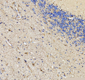 Immunohistochemical staining of ENO1 using anti-ENO1 antibody. ENO1 was detected in a paraffin-embedded section of human cerebellum tissue. Heat mediated antigen retrieval was performed in EDTA buffer (pH 8.0, epitope retrieval solution). The tissue section was blocked with 10% goat serum. The tissue section was then incubated with 2 ug/ml rabbit anti-ENO1 antibody overnight at 4oC. Peroxidase Conjugated Goat Anti-rabbit IgG was used as secondary antibody and incubated for 30 minutes at 37oC. The tissue section was developed using an HRP secondary and DAB substrate.