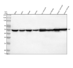 Western blot analysis of BCKDH E2/DBT using anti-BCKDH E2 antibody. Lane 1: human SiHa whole cell lysates, Lane 2: human whole cell lysates, Lane 3: human Hacat whole cell lysates, Lane 4: human Jurkat whole cell lysates, Lane 5: rat stomach tissue lysates, Lane 6: rat kidney tissue lysates, Lane 7: mouse stomach tissue lysates, Lane 8: mouse kidney tissue lysates. After electrophoresis, proteins were transferred to a nitrocellulose membrane at 150 mA for 50-90 minutes. Blocked the membrane with 5% non-fat milk/TBS for 1.5 hour at RT. The membrane was incubated with rabbit anti-BCKDH E2 antibody at 0.5 ug/ml overnight at 4oC, then washed with TBS-0.1%Tween 3 times with 5 minutes each and probed with a goat anti-rabbit IgG-HRP secondary antibody at a dilution of 1:5000 for 1.5 hour at RT. The signal was developed using enhanced chemiluminescent. BCKDH E2 (DBT) antibody detects a single strong band just below the 50 kDa marker in human cell and tissue lysates, slightly faster than the 53.5 kDa predicted mass but consistent with the processed 52 kDa mitochondrial autoantigen form of DBT reported in the literature and typical SDS-PAGE migration behavior of mitochondrial enzymes.