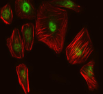 Immunofluorescent staining of SUPT6H using anti-SPT6 antibody (green). SUPT6H was detected in an immunocytochemical section of human TPC1 cells. Enzyme antigen retrieval was performed using IHC enzyme antigen retrieval reagent for 15 mins. The cells were blocked with 10% goat serum. And then incubated with 5 ug/ml rabbit anti-SUPT6H antibody overnight at 4oC. DyLight 488 Conjugated Goat Anti-Rabbit IgG was used as secondary antibody at 1:100 dilution and incubated for 30 minutes at 37oC. The tissue section was developed using Phalloidin-iFluor 594 conjugate (red). Visualize using a fluorescence microscope and filter sets appropriate for the label used.