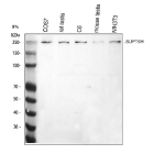 Western blot analysis of SUPT6H using anti-SPT6 antibody. Electrophoresis was performed on a 8% SDS-PAGE gel at 80V (Stacking gel) / 120V (Resolving gel) for 2 hours. Lane 1: monkey COS-7 whole cell lysates, Lane 2: rat testis tissue lysates, Lane 3: rat C6 whole cell lysates, Lane 4: mouse testis tissue lysates, Lane 5: mouse NIH/3T3 whole cell lysates. After electrophoresis, proteins were transferred to a nitrocellulose membrane at 150 mA for 50-90 minutes. Blocked the membrane with 5% non-fat milk/TBS for 1.5 hour at RT. The membrane was incubated with rabbit anti-SUPT6H antibody at 0.5 ug/ml overnight at 4oC, then washed with TBS-0.1%Tween 3 times with 5 minutes each and probed with a goat anti-rabbit IgG-HRP secondary antibody at a dilution of 1:5000 for 1.5 hour at RT. The signal is developed using an ECL Plus Western Blotting Substratewith Tanon 5200 system. A strong band was detected at approximately 250 kDa, which is higher than the predicted 199 kDa and consistent with the known slow-migrating behavior of SUPT6H caused by its acidic, low-complexity domains and extensive phosphorylation.