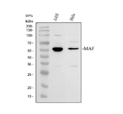 Western blot testing of human HepG2 cell lysate with Sirtuin 3 antibody. Although the predicted molecular weight of the Sirtuin 3 precursor is ~44 kDa, all samples display a prominent ~29 kDa band corresponding to the mature, mitochondrially processed form of Sirtuin 3, consistent with known post-translational cleavage of its N-terminal targeting sequence.