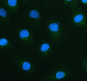 Immunofluorescent staining of FFPE human a549 cells with ACOX1 antibody (green) and Alpha Tubulin mAb (red). HIER: steam section in pH6 citrate buffer for 20 min.