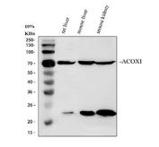 Western blot analysis of ACOX1 in rat liver, mouse liver, and mouse kidney lysates. The ACOX1 antibody detects a strong band at approximately 70 kDa corresponding to full length acyl-CoA oxidase 1 (ACOX1), as well as a prominent band at approximately 22 kDa. The lower band matches the known C terminal 22 kDa fragment generated by proteolytic processing of ACOX1 in peroxisomes, which has been described for mammalian ACOX1 in liver tissues.