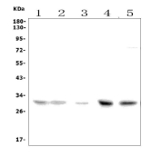 Western blot testing of 1) human HeLa, 2) human Jurkat, 3) human CCRF-CEM, 4) rat brain and 5) mouse brain tissue lysate with SLC25A1 antibody. The SLC25A1 antibody detects a single band at approximately 30 kDa in all samples, which matches the reported apparent molecular weight (30-34 kDa) of the mitochondrial citrate carrier SLC25A1 despite its calculated mass of ~34 kDa.