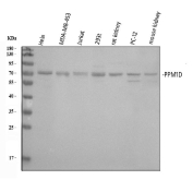 Western blot analysis of human cell lines (HeLa, MDA-MB-453, Jurkat, and 293T), rat kidney, rat PC-12 cells, and mouse kidney tissue lysates using PPM1D antibody. A predominant band is detected just above 70 kDa, consistent with the reported electrophoretic mobility of PPM1D. Human samples show a faint doublet, likely reflecting post-translationally modified forms. An additional lower molecular weight band (~60 kDa) is observed in PC-12 cells, consistent with cell-type-specific processing or truncated PPM1D species.