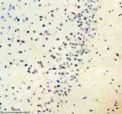 Immunohistochemical staining of FFPE rat brain tissue with Islet 1 antibody, HRP-secondary and DAB substrate. HIER: boil tissue sections in pH8 EDTA for 20 min and allow to cool before testing.