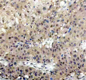 Immunohistochemical staining of FFPE human liver tissue with Islet 1 antibody, HRP-secondary and DAB substrate. HIER: boil tissue sections in pH8 EDTA for 20 min and allow to cool before testing.