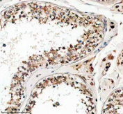 Immunohistochemical staining of FFPE human testis tissue with Phospho-LIPE (pSer853) antibody, HRP-secondary and DAB substrate. HIER: boil tissue sections in pH8 EDTA for 20 min and allow to cool before testing.