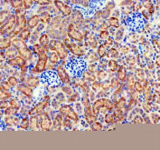 Immunohistochemical staining of FFPE mouse kidney tissue with Sonic Hedgehog antibody, HRP-secondary and DAB substrate. HIER: boil tissue sections in pH8 EDTA for 20 min and allow to cool before testing.