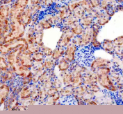 Immunohistochemical staining of FFPE rat kidney tissue with Sonic Hedgehog antibody, HRP-secondary and DAB substrate. HIER: boil tissue sections in pH8 EDTA for 20 min and allow to cool before testing.