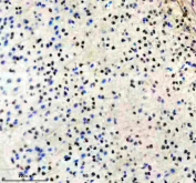 Immunohistochemical staining of FFPE mouse brain tissue with Phospho-Sirtuin 1 (pSer47) antibody, HRP-secondary and DAB substrate. HIER: boil tissue sections in pH8 EDTA for 20 min and allow to cool before testing.