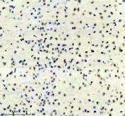Immunohistochemical staining of FFPE rat brain tissue with Phospho-Sirtuin 1 (pSer47) antibody, HRP-secondary and DAB substrate. HIER: boil tissue sections in pH8 EDTA for 20 min and allow to cool before testing.
