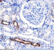 Immunohistochemical staining of FFPE human kidney tissue with NCAM-L1 antibody, HRP-secondary and DAB substrate. HIER: boil tissue sections in pH8 EDTA for 20 min and allow to cool before testing.