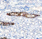 Immunohistochemical staining of FFPE human kidney tissue with NCAM-L1 antibody, HRP-secondary and DAB substrate. HIER: boil tissue sections in pH8 EDTA for 20 min and allow to cool before testing.