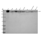 Western blot testing of human HeLa, SiHa, U-2 OS, MCF7, rat brain and C6 and mouse brain and Neuro-2a cell lysate with NCAM-L1 antibody. Predicted molecular weight ~140 kDa (unglycosylated form). A band is detected at approximately 250 kDa, consistent with the heavily glycosylated form of NCAM-L1. A lower molecular weight band is also observed, consistent with processed or partially glycosylated NCAM-L1 species.
