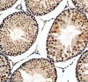 Immunohistochemical staining of FFPE rat testis tissue with ERCC2 antibody, HRP-secondary and DAB substrate. HIER: boil tissue sections in pH8 EDTA for 20 min and allow to cool before testing.