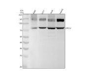 Western blot analysis of ERCC2 expression in human cell lysates using ERCC2 antibody. A primary band is detected at approximately 73 kDa, corresponding to endogenous ERCC2. Additional higher molecular weight bands between approximately 130-150 kDa are observed, consistent with modified or complex-associated forms of ERCC2.