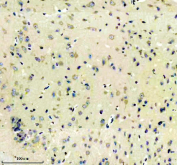 Immunohistochemical staining of FFPE mouse brain tissue with EEA1 antibody, HRP-secondary and DAB substrate. HIER: boil tissue sections in pH8 EDTA for 20 min and allow to cool before testing.