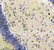 Immunohistochemical staining of FFPE rat brain tissue with EEA1 antibody, HRP-secondary and DAB substrate. HIER: boil tissue sections in pH8 EDTA for 20 min and allow to cool before testing.