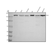 Western blot analysis of EEA1 expression in HeLa, 293T, rat brain, rat C6, mouse brain, and mouse NIH/3T3 lysates using EEA1 antibody. A specific band is detected at approximately 162 kDa, corresponding to the predicted molecular weight of Early endosome antigen 1.