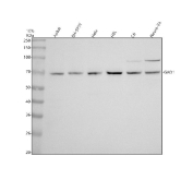 Western blot analysis of GAD1 expression in human Jurkat, SH-SY5Y, HeLa, HEL, rat C6, and mouse Neuro-2a cell lysates using Glutamate decarboxylase 1 antibody. A major band is detected at approximately 67-70 kDa, corresponding to GAD1 (GAD67). An additional higher molecular weight band of approximately 90 kDa is observed in C6 and Neuro-2a cells, which may reflect a modified or complex-associated form of GAD67 in neural cell lines.