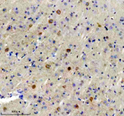 Immunohistochemical staining of FFPE pig brain tissue with Glutamate decarboxylase 1 antibody, HRP-secondary and DAB substrate. HIER: boil tissue sections in pH8 EDTA for 20 min and allow to cool before testing.