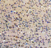 Immunohistochemical staining of FFPE mouse brain tissue with Glutamate Receptor 2 antibody, HRP-secondary and DAB substrate. HIER: boil tissue sections in pH8 EDTA for 20 min and allow to cool before testing.