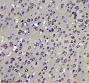 Immunohistochemical staining of FFPE rat brain tissue with Glutamate Receptor 2 antibody, HRP-secondary and DAB substrate. HIER: boil tissue sections in pH8 EDTA for 20 min and allow to cool before testing.