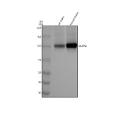 Western blot analysis of rat brain and mouse brain tissue lysates using Glutamate Receptor 2 antibody. Predicted molecular weight ~99 kDa.
