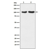 Western blot analysis of GluR2+GluR3 expression in (1) human fetal brain lysate; (2) mouse brain lysate using GluR2/GluR3 antibody. Predicted molecular weight ~99 kDa.
