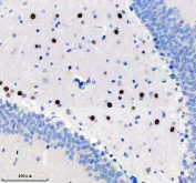Immunohistochemical analysis of BIRC2 using anti-BIRC2 antibody. BIRC2 is detected in a paraffin-embedded section of rat brain tissue following heat-mediated antigen retrieval in EDTA buffer (pH 8.0). Positive staining is observed in a subset of brain cells, consistent with reported BIRC2 expression patterns.