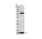 Western blot testing of human K562 cell lysate with FTO antibody. Predicted molecular weight ~58 kDa.
