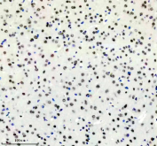 Immunohistochemical staining of FFPE mouse brain tissue with DDX17 antibody, HRP-secondary and DAB substrate. HIER: boil tissue sections in pH8 EDTA for 20 min and allow to cool before testing.