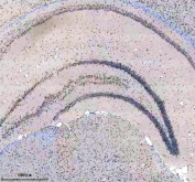 Immunohistochemical staining of FFPE mouse brain tissue with DDX17 antibody, HRP-secondary and DAB substrate. HIER: boil tissue sections in pH8 EDTA for 20 min and allow to cool before testing.