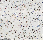 Immunohistochemical staining of FFPE rat brain tissue with DDX17 antibody, HRP-secondary and DAB substrate. HIER: boil tissue sections in pH8 EDTA for 20 min and allow to cool before testing.