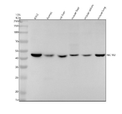 Western blot analysis of NCR2 expression using anti-NCR2 antibody. Lysates include human K562 cells, human Ramos cells, rat liver tissue, mouse liver tissue, mouse spleen tissue, and mouse lung tissue. A specific band is detected at approximately 40-45 kDa. NCR2 has a predicted molecular weight of ~31 kDa; however, the mature protein is a glycosylated cell surface receptor and may be observed at higher apparent molecular weights, up to ~44 kDa, due to N-linked glycosylation.