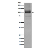 Western blot analysis of GRM1 expression using anti-GRM1 antibody and mouse brain tissue lysate. GRM1 has a predicted molecular weight of ~132 kDa; however, a major band may be observed at ~100-110 kDa when the receptor is present as a less glycosylated form or as a processed species, which can migrate below the predicted size depending on tissue preparation and denaturation conditions.