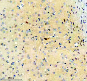 Immunohistochemical analysis of GRM1 using anti-GRM1 antibody. GRM1 is detected in a paraffin-embedded section of rat brain tissue following heat-mediated antigen retrieval. Staining is observed in neuronal cell bodies and surrounding neuropil, consistent with known expression and localization patterns of Metabotropic glutamate receptor 1 in the rat brain.