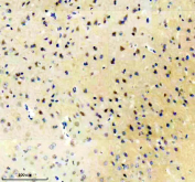Immunohistochemical analysis of GRM1 using anti-GRM1 antibody. GRM1 is detected in a paraffin-embedded section of mouse brain tissue following heat-mediated antigen retrieval. Cell-associated staining is observed in neuronal populations and surrounding neuropil, consistent with reported expression patterns of Metabotropic glutamate receptor 1 in the brain.