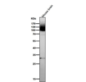 Western blot analysis of GRM1 expression using anti-GRM1 antibody and mouse brain tissue lysate. GRM1 has a predicted molecular weight of ~132 kDa; however, a major band may be observed at ~100-110 kDa when the receptor is present as a less glycosylated form or as a processed species, which can migrate below the predicted size depending on tissue preparation and denaturation conditions.